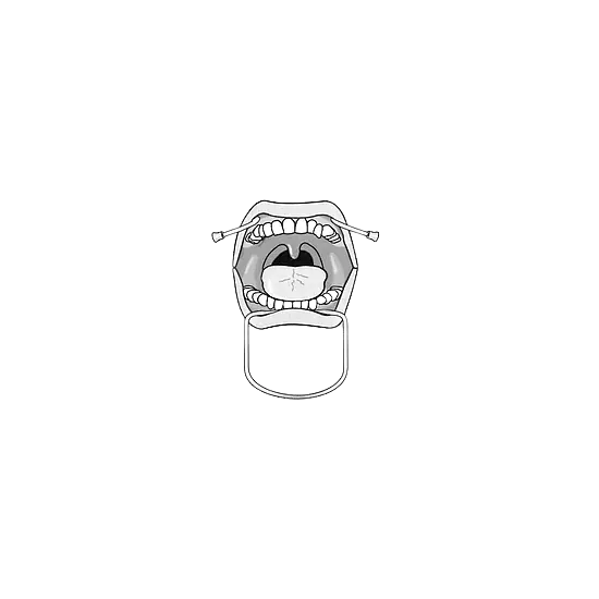 Ретрактор (роторозширювач)...