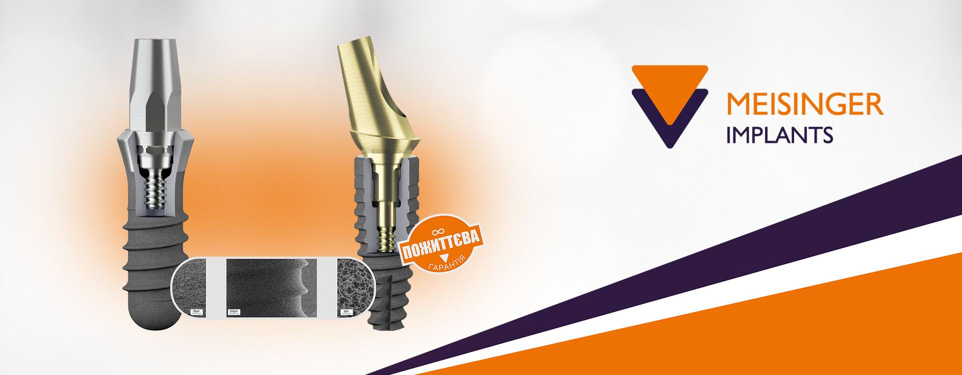 Meisinger Implants: Інновації та якість у дентальній імплантології